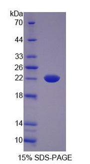 Figure 1. SDS-PAGE