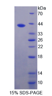 Figure 1. SDS-PAGE