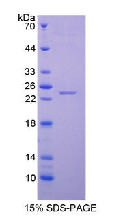 Figure 1. SDS-PAGE