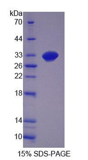 Figure 1. SDS-PAGE