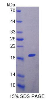 Figure 1. SDS-PAGE