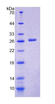 Figure 1. SDS-PAGE