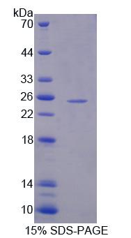 Figure 1. SDS-PAGE