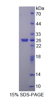 Figure 1. SDS-PAGE