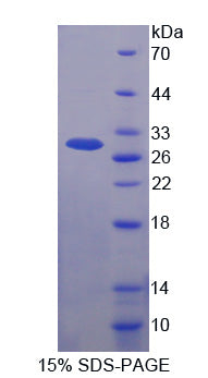 Figure 1. SDS-PAGE