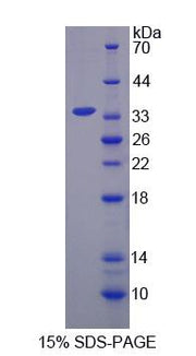Figure 1. SDS-PAGE