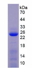 Figure 3. SDS-PAGE
