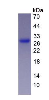 Figure 3. SDS-PAGE