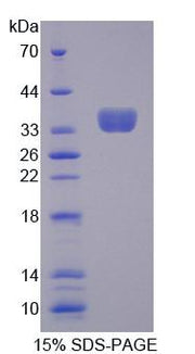 Figure 1. SDS-PAGE