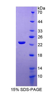 Figure 1. SDS-PAGE