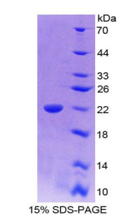 Figure 1. SDS-PAGE