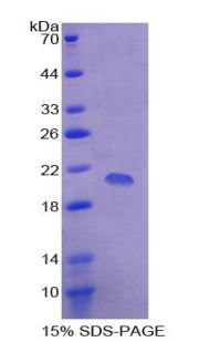 Figure 1. SDS-PAGE