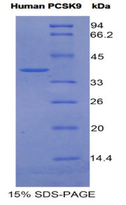 Figure 1. SDS-PAGE