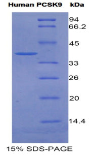 Figure 1. SDS-PAGE