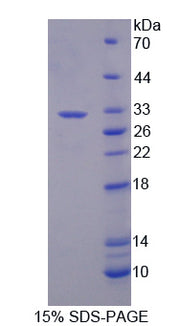 Figure 1. SDS-PAGE