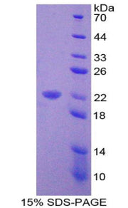 Figure 1. SDS-PAGE