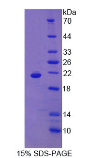 Figure 1. SDS-PAGE