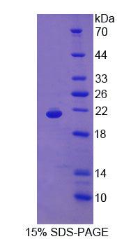 Figure 1. SDS-PAGE