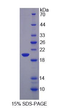 Figure 1. SDS-PAGE