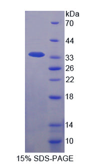 Figure 1. SDS-PAGE