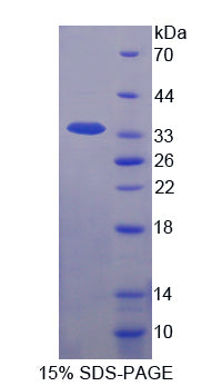 Figure 1. SDS-PAGE