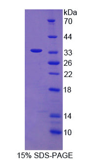 Figure 1. SDS-PAGE