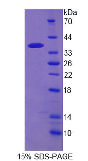Figure 1. SDS-PAGE