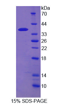 Figure 1. SDS-PAGE
