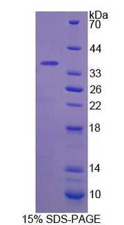 Figure 1. SDS-PAGE