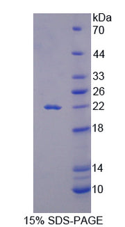 Figure 1. SDS-PAGE