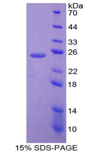 Figure 1. SDS-PAGE