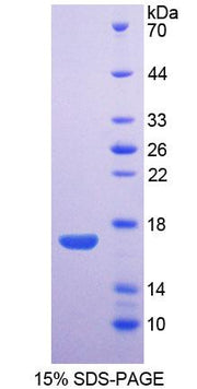 Figure 1. SDS-PAGE
