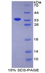Figure 1. SDS-PAGE