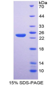 Figure 1. SDS-PAGE