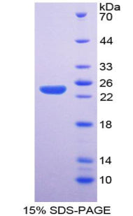Figure 1. SDS-PAGE