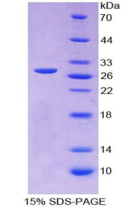 Figure 1. SDS-PAGE