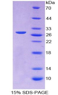 Figure 1. SDS-PAGE