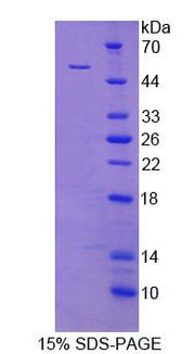 Figure 1. SDS-PAGE
