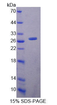Figure 1. SDS-PAGE