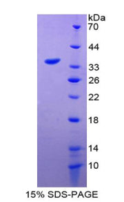 Figure 1. SDS-PAGE