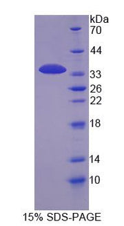 Figure 1. SDS-PAGE