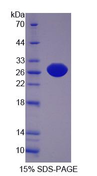 Figure 1. SDS-PAGE