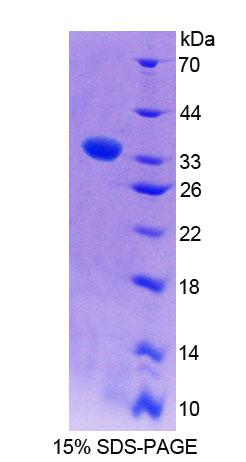 Figure 1. SDS-PAGE
