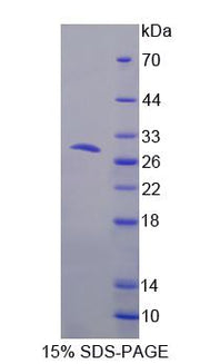 Figure 1. SDS-PAGE