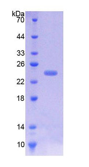 Figure 1. SDS-PAGE