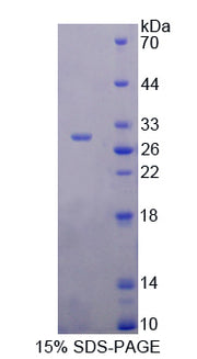 Figure 1. SDS-PAGE