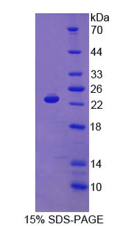 Figure 1. SDS-PAGE