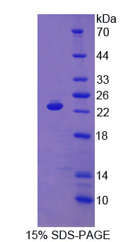 Figure 1. SDS-PAGE