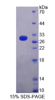 Figure 1. SDS-PAGE
