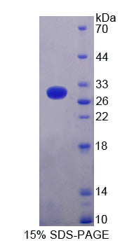 Figure 1. SDS-PAGE
